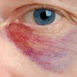 Is Woman-on-Man Domestic Violence Common?